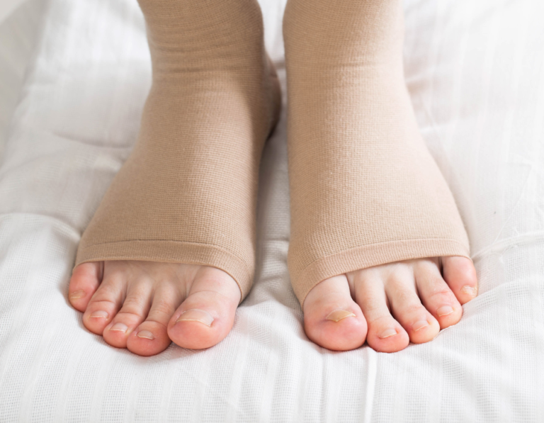 a photo of a foot experiencing Edema and Lymphedema​