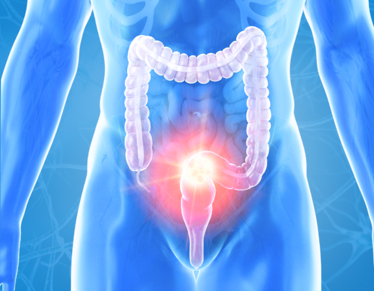 An image showing a person's colon for our colon cleanse program.